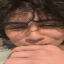 SBBB Sever